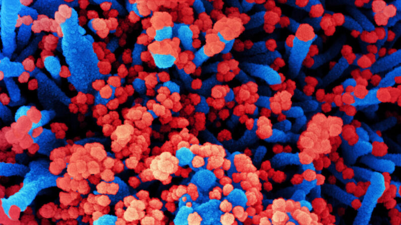 Micrografía electrónica de barrido sin fechar de una célula (azul) fuertemente infectada con partículas del virus del PCCh —también conocido como SARS-CoV-2— (rojo), aislada de una muestra de un paciente en la Instalación de Investigación Integrada (IRF) del NIAID en Fort Detrick, Maryland, el 31 de octubre de 2020. (NIAID)