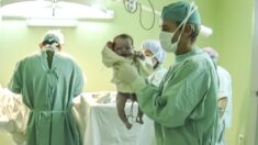 Insólito caso de bebé que nació con una “cola” de 12 cm de largo sorprende a médicos en Brasil