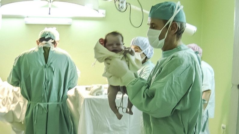 Insólito caso de bebé que nació con una “cola” de 12 cm de largo sorprende a médicos en Brasil