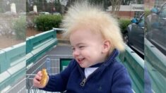 Niño diagnosticado con «síndrome del cabello impeinable» cautiva a miles