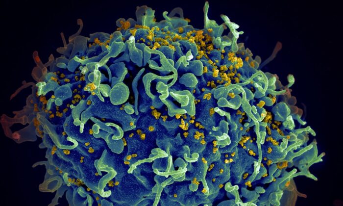 El virus de la inmunodeficiencia humana (amarillo) infectando una célula humana. (Instituto Nacional del Cáncer/Unsplash)