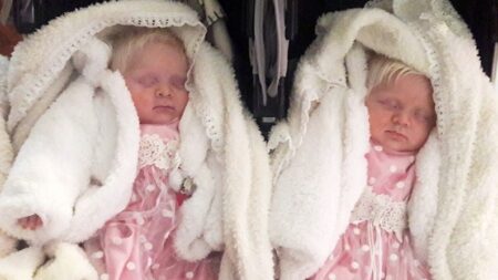 Padres argentinos tienen raras gemelas albinas, ahora cuentan su experiencia con sus hijas de 4 años