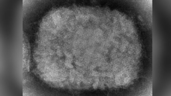 Un virión de la viruela del mono, obtenido de una muestra clínica asociada al brote en perros de la pradera de 2003, en una imagen de microscopio electrónico. (Cynthia S. Goldsmith/CDC)