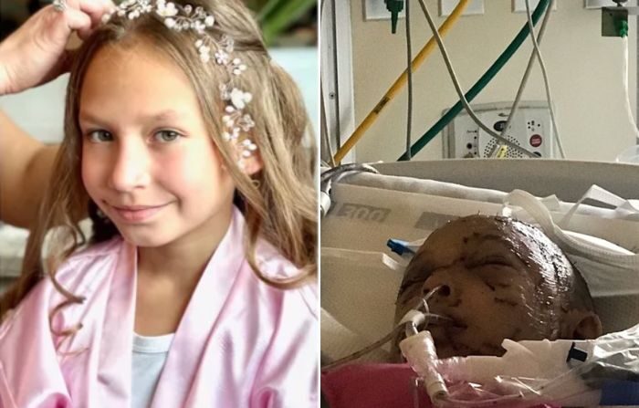 Lily A. Kryzhanivskyy, antes y después del ataque del puma. (GoFundMe)