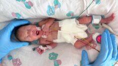 Mamá dice su bebé prematura nacida 14 semanas antes es un “milagro absoluto y una perfección total”
