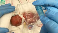 Bebé de 310 gramos al nacer y el más pequeño en sobrevivir en UCIN del hospital, ¡se va a casa!