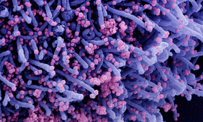 Micrografía electrónica de barrido coloreada de una célula (púrpura) infectada con una cepa variante del virus SARS-CoV-2 (rosa), aislada de una muestra de un paciente. (NIAID vía The Epoch Times)