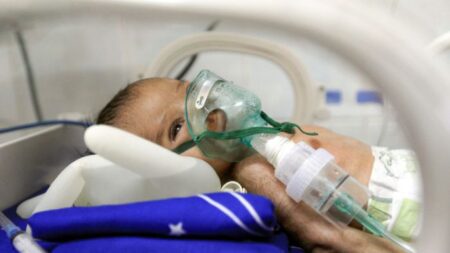 Extraño caso de bebé que nació con un «cuerno» en lugar de piernas desconcierta a médicos