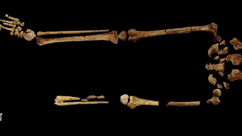 El esqueleto al que le falta el pie y la extremidad inferior izquierda. (Fotografía por cortesía del Dr. Tim Maloney, Universidad de Griffith. Suministrada a The Epoch Times por la UWA)