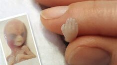 Fotos de bebé abortado de 14 semanas “perfectamente formado” salvan vidas: “No era un residuo médico”