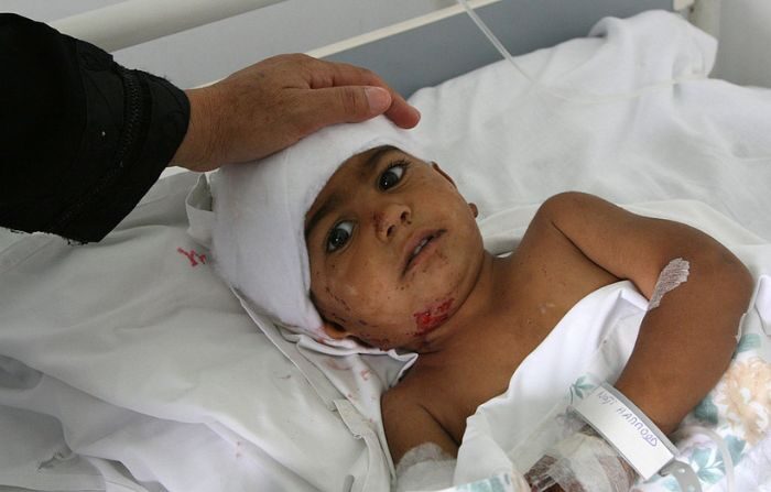 Niño en cama de hospital. Imagen ilustrativa. (AFP/GettyImages)