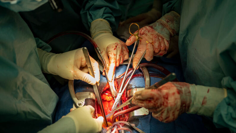 Un grupo de cirujanos cardiovasculares realizan un trasplante de corazón en un quirófano en una imagen de archivo. (Foto de JAVIER SORIANO/AFP a través de Getty Images)