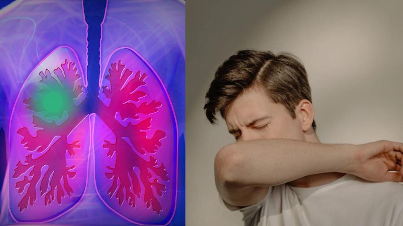 El cáncer de pulmón es la primera causa de muerte en el mundo. (Pexels / cottonbro studio) (Pixabay / kalhh)