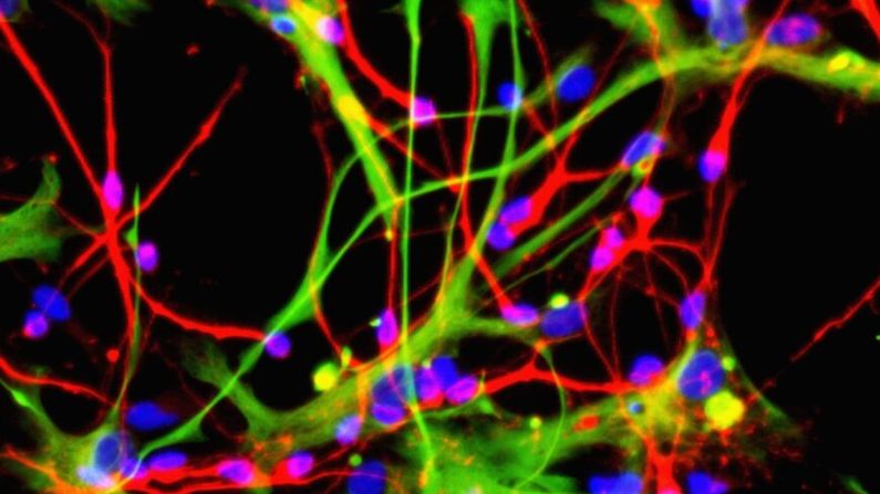Neuronas (en rojo) y astrocitos (en verde), que pueden fabricarse a partir de células madre neurales, en esta foto de archivo sin fecha, publicada por el Instituto de Investigación de Células Madre el 16 de agosto del 2005. (Instituto de Investigación sobre Células Madre vía Getty Images)