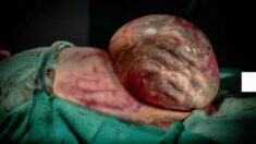 Fotógrafa toma increíbles imágenes de bebé nacido por cesárea dentro de su saco amniótico