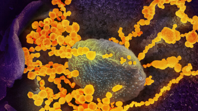 Una imagen de microscopio electrónico muestra el SARS-CoV-2 (objetos dorados redondos), que causa el COVID-19, emergiendo de células cultivadas. (NIAID)