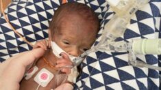 Bebé prematuro que parecía muñequito al nacer cumple 2 años, así está ahora este pequeño milagro