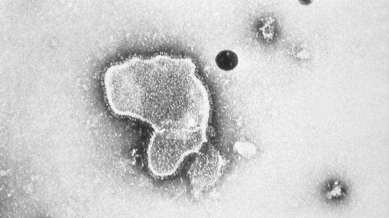 Un virus respiratorio sincitial humano, también conocido como VSR, en una imagen de microscopio electrónico de 1981. (Centros para el Control y la Prevención de Enfermedades vía AP)