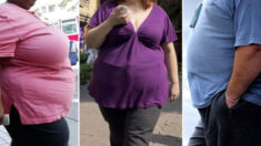 «Fuerte asociación» entre obesidad y enfermedades autoinmunes, según artículo