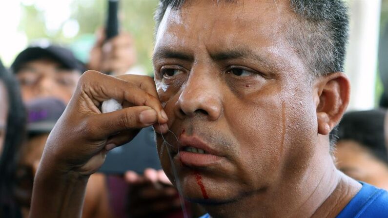 Un migrante se cose la boca durante una protesta en la ciudad de Huixtla, estado de Chiapas (México). EFE/ Juan Manuel Blanco