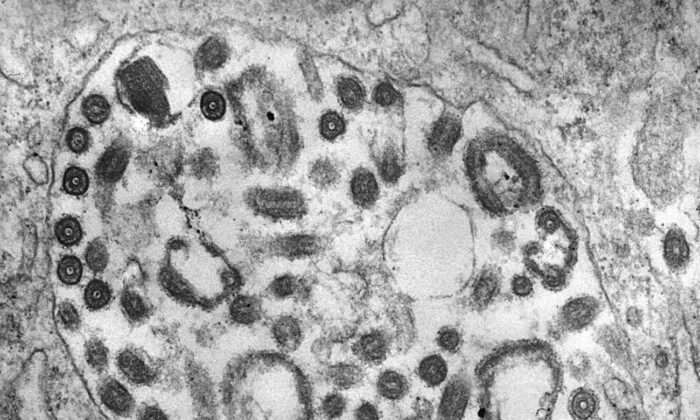 Esta imagen de microscopía electrónica de transmisión (TEM), de 1975, tomada a una muestra de tejido no revelada, muestra la presencia de numerosas partículas del virus de Marburg. (CDC/Dr. Fred Murphy; Sylvia Whitfield)
