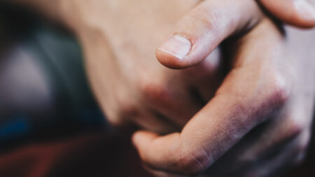 Afecciones comunes en las uñas pueden indicar que tuvo COVID