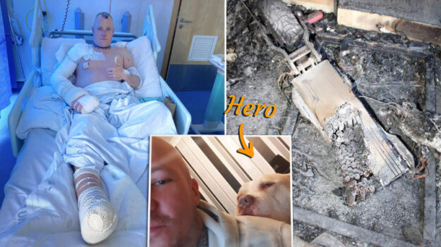 Su mascota lo salvó de morir quemado: «Mi corazón está roto por mi perro héroe»