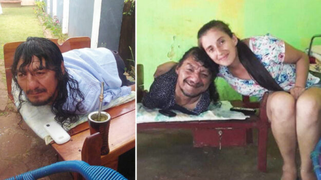 Papá sin brazos ni piernas cría 2 hijas tras ser abandonadas por su mamá: «Siempre tiene una sonrisa»