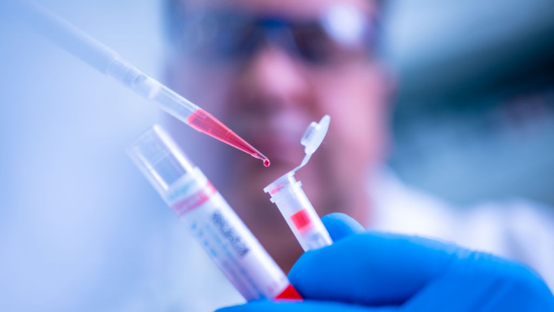 Empleado de la empresa alemana de biotecnología Qiagen demuestra el uso del dispositivo de pruebas QIAamp Viral RNA Mini Kit para enfermedades infecciosas en la planta de Qiagen el 11 de marzo de 2020 en Hilden, Alemania.  (Sascha Schuermann/Getty Images)