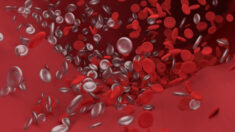Reduzca el riesgo de coágulos sanguíneos tras COVID-19 o la vacunación con 4 hábitos