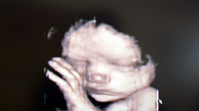 Una ecografía 3D que muestra a un bebé dentro del útero. (Fotopress/Getty Images)
