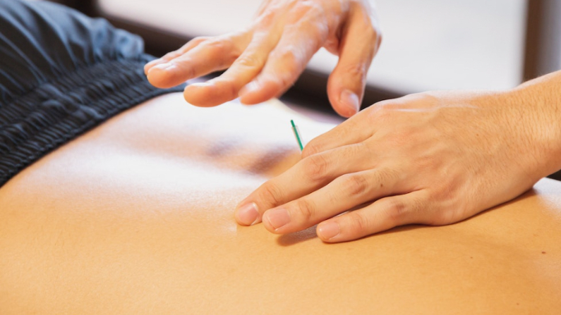 La acupuntura demostró ser eficaz para los pacientes que reciben tratamiento de diálisis. (Pexels/ Ryutaro Tsukata)