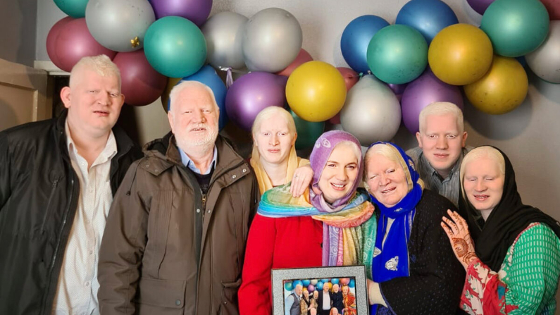 Familia con el récord mundial de más hermanos albinos cuenta su historia: "Me gusta ser quien soy"