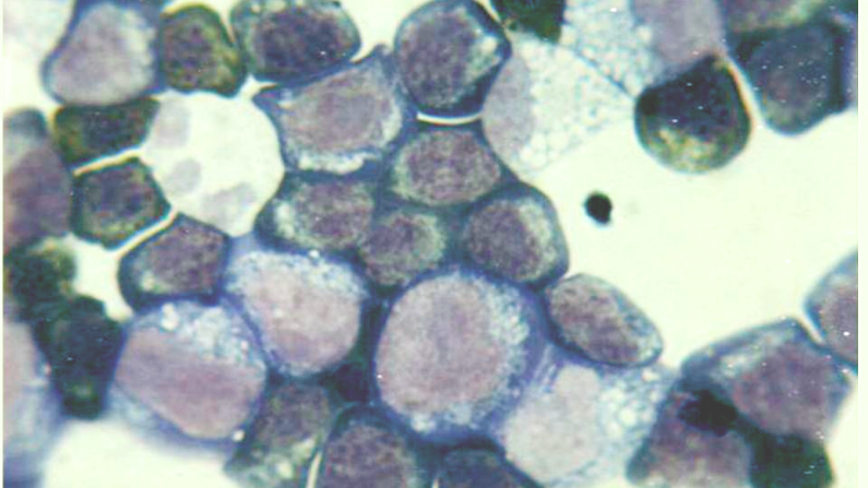 Tipos de células de la medula osea. El color de la imagen fue editado. (Jucomo/ (CC BY-SA 3.0)