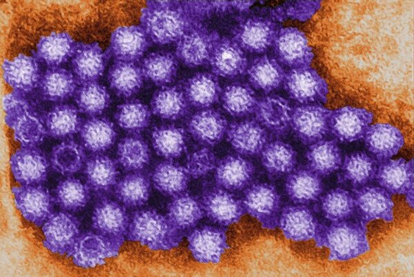 Aumentan casos de Norovirus, sobre todo al noreste de Estados Unidos, revelan los CDC