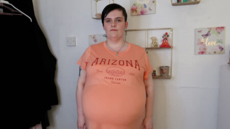 Mujer con quiste estomacal de 40 cm parecía embarazada y tras la cirugía se siente una «nueva persona»