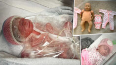 Bebé nacida 2 meses antes era tan pequeñita que vistió ropa de muñeca, pero ya se está recuperando