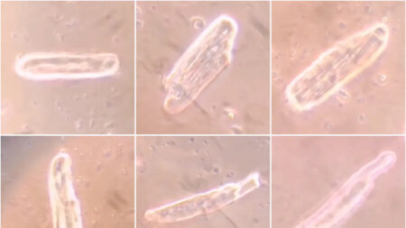 Las vacunas COVID de ARNm forman la proteína de espiga en el corazón y causan anomalías, según investigación