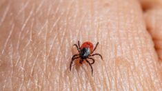La guía esencial de la enfermedad de Lyme: Síntomas, Causas, Tratamientos y Enfoques Naturales