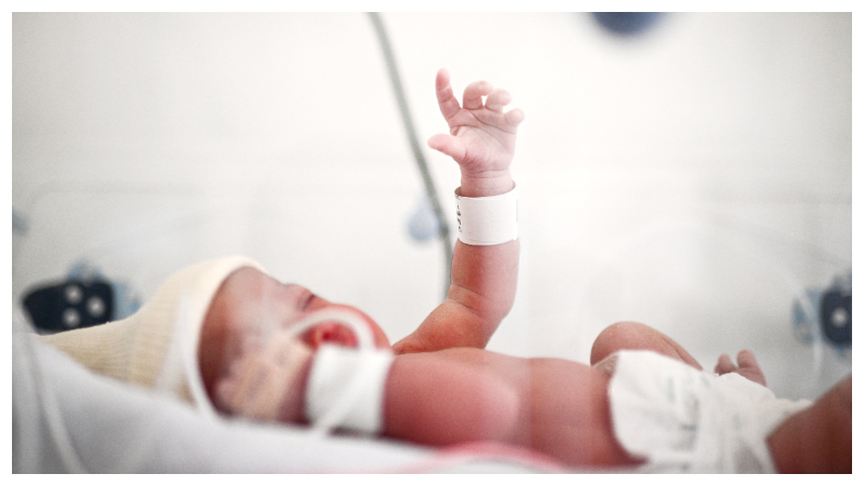 Un recién nacido reposa en una incubadora momentos después de su nacimiento en la sala de maternidad de un hospital de París el 29 de junio de 2022. (Foto de CHRISTOPHE ARCHAMBAULT/AFP vía Getty Images)