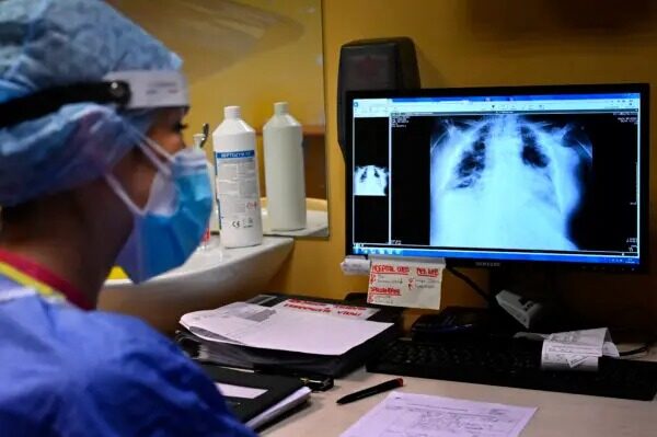 Una enfermera observa las radiografías pulmonares de un paciente con COVID-19 en el hospital de Casalpalocco, al sur de Roma, el 13 de octubre del 2021. (ALBERTO PIZZOLI/AFP vía Getty Images)