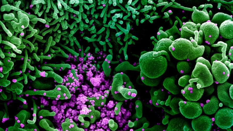 Micrografía electrónica de barrido coloreada de una célula (verde) fuertemente infectada con partículas del COVID-19 (púrpura), comúnmente conocidas como SARS-CoV-2 o nuevo virus del PCCh, aislado de una muestra de un paciente el 16 de marzo de 2020. (NIAID)