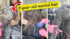 Mujer se libera de un «dolor de cabeza permanente» luego de 10 horas para desenredar su enmarañado cabello