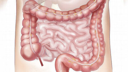 ¿Es su apéndice un héroe de la salud intestinal?