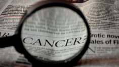 Sobrediagnóstico de cáncer de piel: un problema creciente