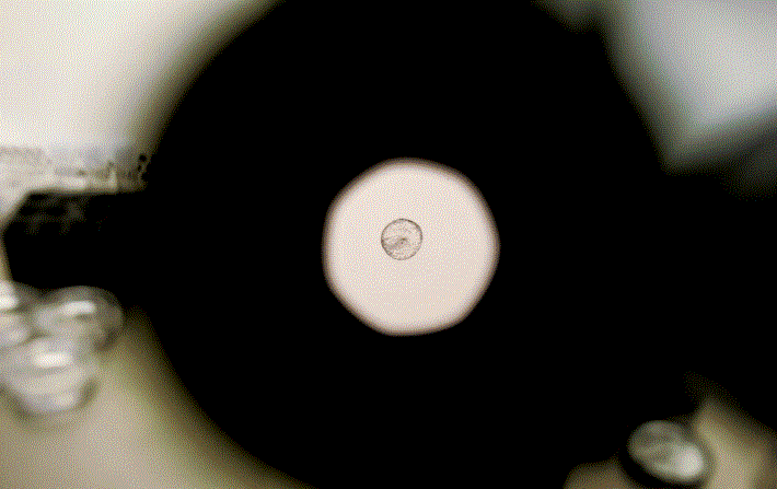 Un embrión humano donado se observa a través de un microscopio en la Clínica La Jolla de Fecundación In Vitro en La Jolla, California, el 28 de febrero de 2007. (Sandy Huffaker/Getty Images)