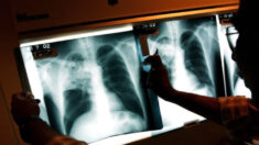 Enfermedades pulmonares mortales alcanzan nivel más alto en 10 años, los niños los más afectados: CDC