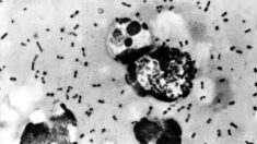 Hombre muere de peste bubónica en Nuevo México
