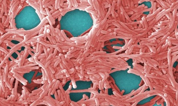 Micrografía electrónica de barrido (SEM) coloreada de la bacteria Legionella pneumophila. (Janice Haney Carr/CDC/Dominio público)