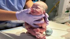 Bebé que nace sin ojos y con la mitad de su cerebro desconcierta a los médicos alcanzando sus hitos